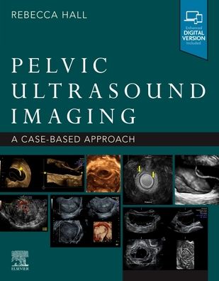 Cover for Hall · Pelvic Ultrasound Imaging: A Cased-Based Approach (Paperback Book) (2021)