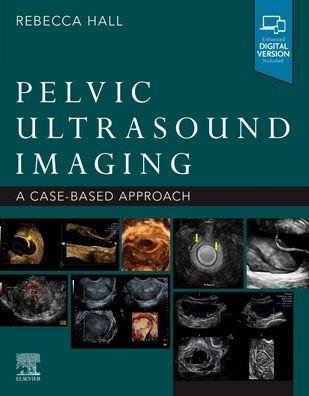 Cover for Hall · Pelvic Ultrasound Imaging: A Cased-Based Approach (Taschenbuch) (2021)