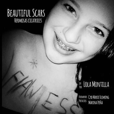 Cover for Cyd Marie Fleming · Beautiful Scars Hermosas Cicatrices (Taschenbuch) (2014)