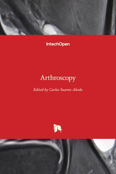 Cover for Carlos Suarez-Ahedo · Arthroscopy (Hardcover Book) (2022)