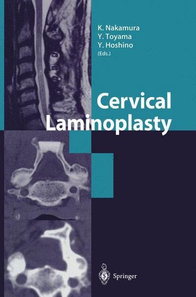 Cover for K Nakamura · Cervical Laminoplasty (Pocketbok) [Softcover reprint of the original 1st ed. 2003 edition] (2012)