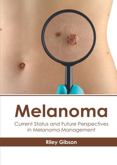 Cover for Riley Gibson · Melanoma: Current Status and Future Perspectives in Melanoma Management (Innbunden bok) (2020)