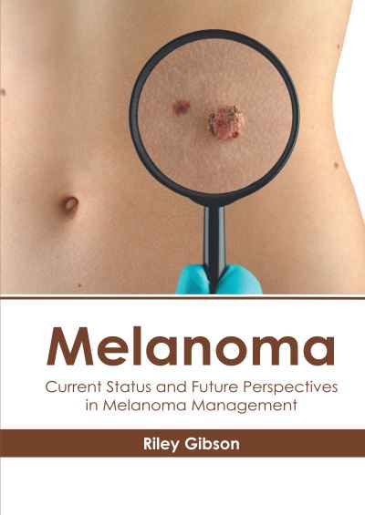 Cover for Riley Gibson · Melanoma: Current Status and Future Perspectives in Melanoma Management (Gebundenes Buch) (2020)