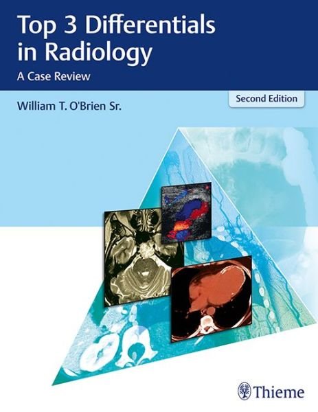 Cover for William T. O'Brien · Top 3 Differentials in Radiology: A Case Review - Top 3 Differentials (Innbunden bok) (2018)