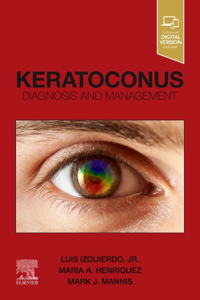 Cover for Luis Izquierdo · Keratoconus: Diagnosis and Management (Taschenbuch) (2022)