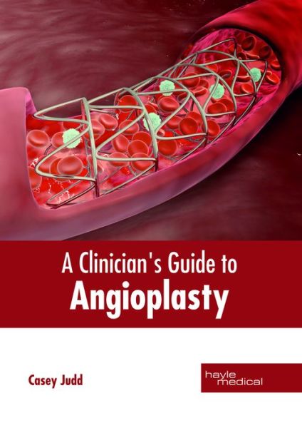 Cover for Casey Judd · Clinician's Guide to Angioplasty (Hardcover Book) (2018)