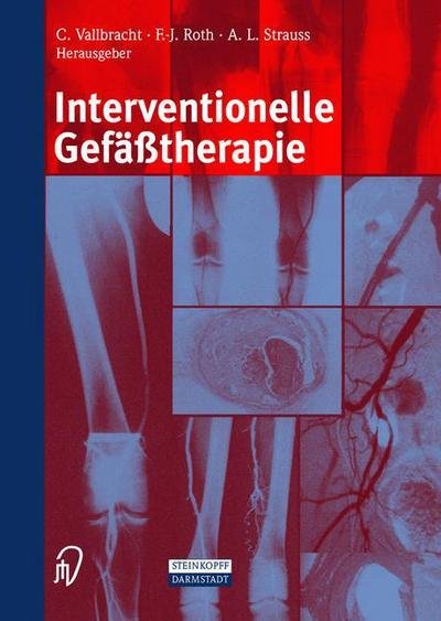 Interventionelle Gefasstherapie - C Vallbracht - Bøger - Steinkopff Darmstadt - 9783798512788 - 1. august 2002