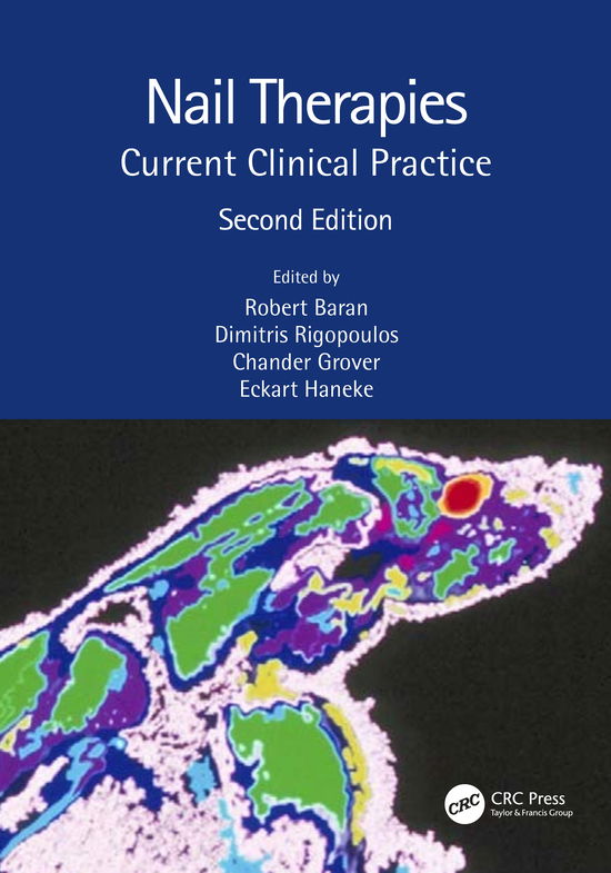 Cover for Rigopoulos, Dimitris (National and Kapodistrian University of Athens, Greece) · Nail Therapies: Current Clinical Practice (Paperback Book) (2021)