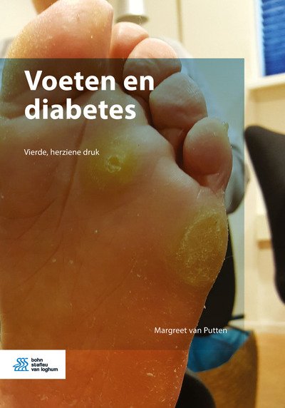 Cover for Margreet van Putten · Van Putten:voeten en Diabetes (Book) (2016)