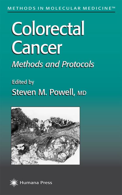 Cover for Steven M Powell · Colorectal Cancer: Methods and Protocols - Methods in Molecular Medicine (Paperback Book) [Softcover reprint of hardcover 1st ed. 2001 edition] (2010)