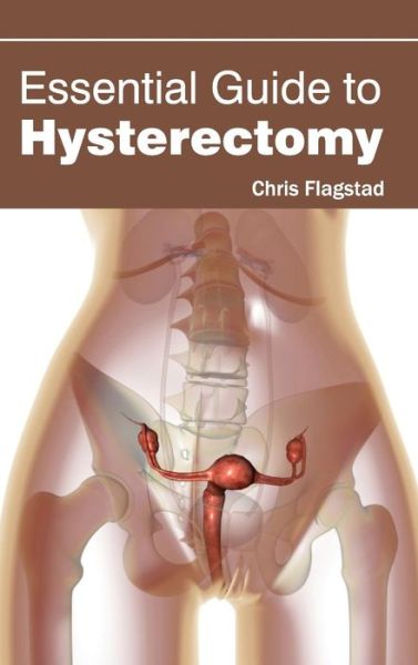 Cover for Chris Flagstad · Essential Guide to Hysterectomy (Hardcover Book) (2015)