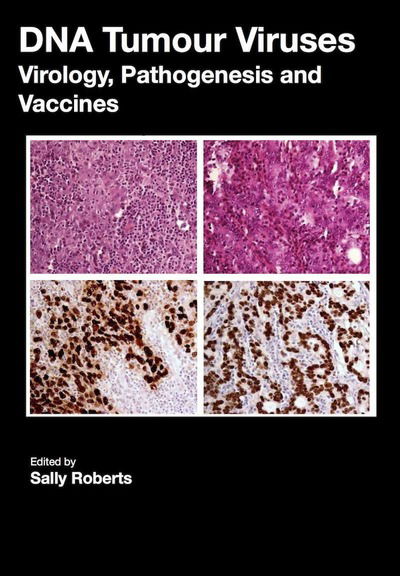 Cover for Sally Roberts · DNA Tumour Viruses (Paperback Book) (2018)