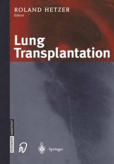 Lung Transplantation - R Hetzer - Libros - Steinkopff Darmstadt - 9783662046791 - 3 de octubre de 2013