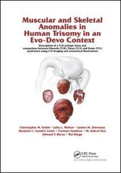 Cover for Rui Diogo · Muscular and Skeletal Anomalies in Human Trisomy in an Evo-Devo Context: Description of a T18 Cyclopic Fetus and Comparison Between Edwards (T18), Patau (T13) and Down (T21) Syndromes Using 3-D Imaging and Anatomical Illustrations (Paperback Bog) (2019)