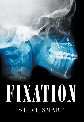 Cover for Steve Smart · Fixation (Hardcover Book) (2019)