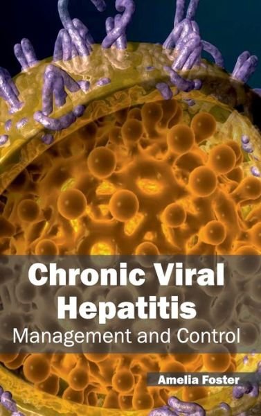 Cover for Amelia Foster · Chronic Viral Hepatitis: Management and Control (Hardcover Book) (2015)