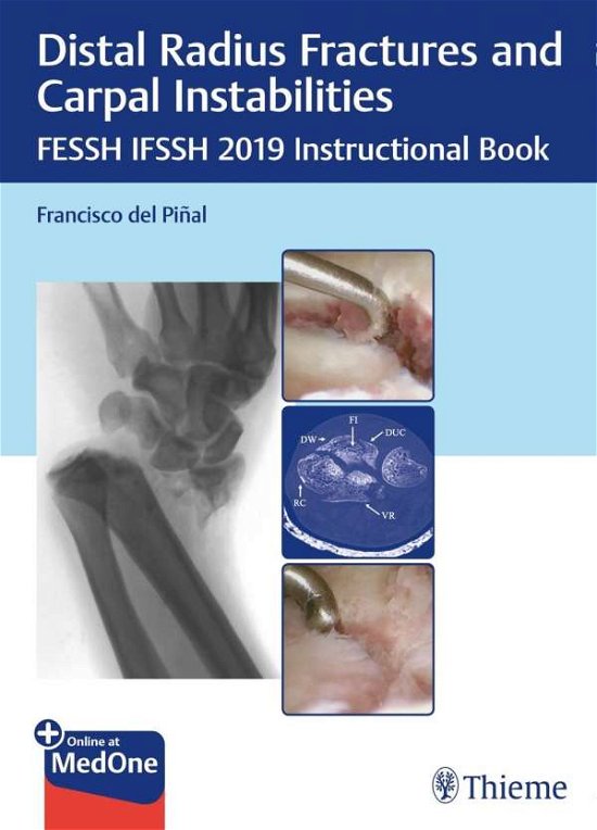 Distal Radius Fractures and Carpal Instabilities: FESSH IFSSH 2019 Instructional Book - Francisco del Pinal - Books - Thieme Publishing Group - 9783132423794 - July 10, 2019