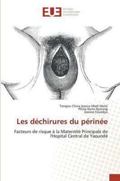 Cover for Madi Malai Tongou China Jessica · Les Dechirures Du Perinee (Paperback Book) (2015)