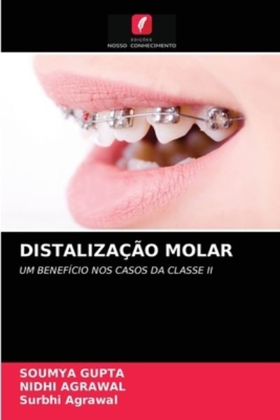 Cover for Soumya Gupta · Distalizacao Molar (Paperback Book) (2021)
