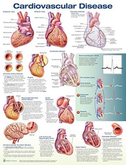 Cardiovascular Disease Anatomical Chart - Anatomical Chart Com - Kirjat - Lippincott Williams and Wilkins - 9781496369796 - tiistai 19. joulukuuta 2017