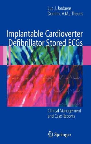 Cover for Luc J. Jordaens · Implantable Cardioverter Defibrillator Stored Ecgs: Clinical Management and Case Reports (Hardcover Book) (2007)