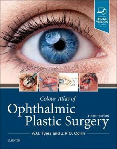 Colour Atlas of Ophthalmic Plastic Surgery - Tyers, Anthony G. (Consultant in Ophthalmic Surgeon, Salisbury District Hospital, Salisbury, UK and Moorfields Eye Hospital, London, UK) - Böcker - Elsevier - Health Sciences Division - 9780323476799 - 15 november 2017