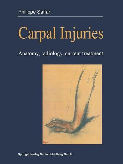 Cover for Philippe Saffar · Carpal injuries: Anatomy, radiology, current treatment (Paperback Book) [Softcover reprint of the original 1st ed. 1990 edition] (2013)