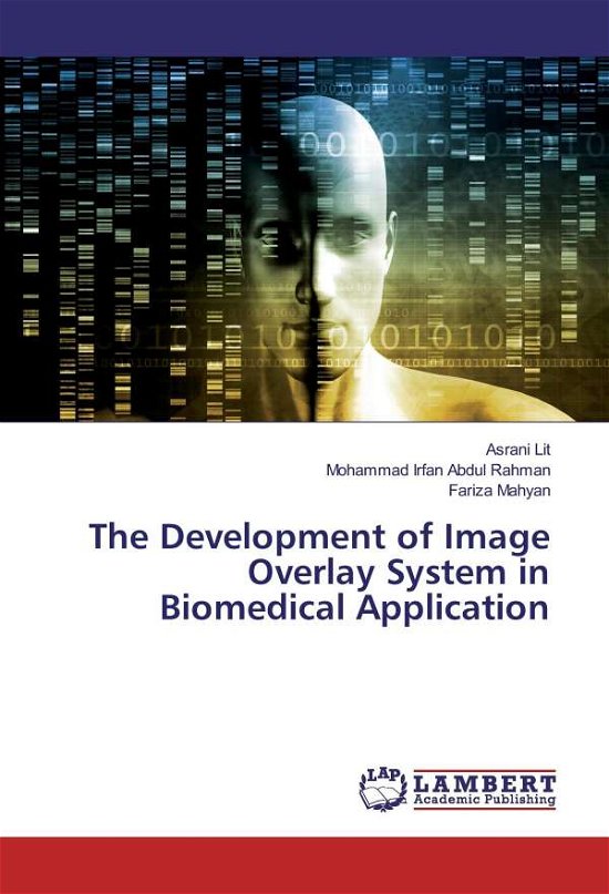 Cover for Lit · The Development of Image Overlay Sy (Bok)