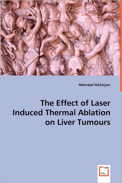 Cover for Mehrdad Nikfarjam · The Effect of Laser Induced Thermal Ablation on Liver Tumours (Pocketbok) (2008)