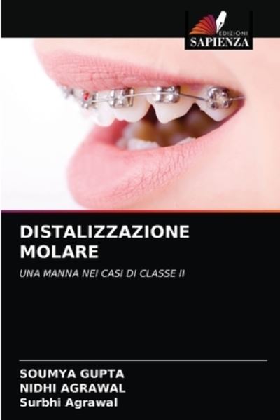 Cover for Soumya Gupta · Distalizzazione Molare (Paperback Book) (2021)