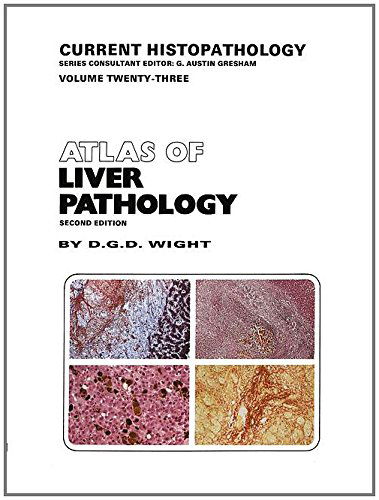 D.G. Wight · Atlas of Liver Pathology - Current Histopathology (Paperback Book) [2nd ed. 1993. Softcover reprint of the original 2n edition] (2012)