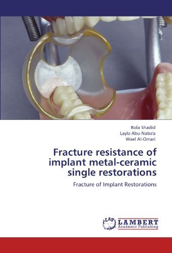 Cover for Wael Al-omari · Fracture Resistance of Implant Metal-ceramic Single Restorations: Fracture of Implant Restorations (Paperback Book) (2011)