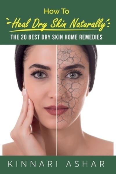 Cover for Kinnari Ashar · How to Heal Dry Skin Naturally (Book) (2022)