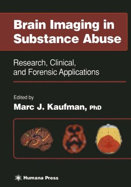 Cover for Marc J Kaufman · Brain Imaging in Substance Abuse: Research, Clinical, and Forensic Applications - Forensic Science and Medicine (Paperback Book) [Softcover reprint of the original 1st ed. 2001 edition] (2011)