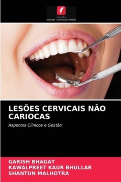 Cover for Garish Bhagat · Lesoes Cervicais Nao Cariocas (Paperback Book) (2021)