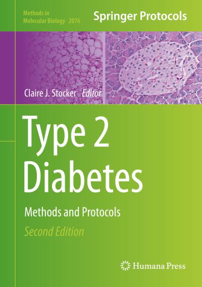 Cover for Type 2 Diabetes (Book) [2nd ed. 2020 edition] (2019)