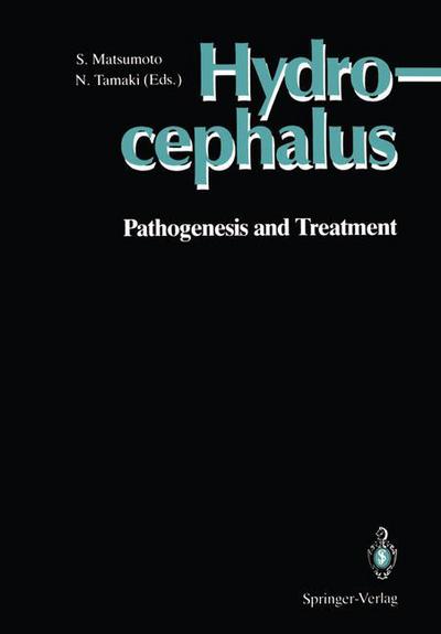 Cover for Hydrocephalus: Pathogenesis and Treatment (Hardcover Book) (1991)