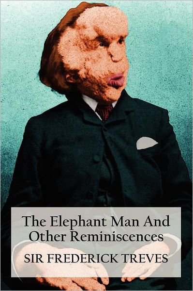 The Elephant Man and Other Reminiscences - Frederick Treves - Livros - Benediction Classics - 9781781391808 - 9 de maio de 2012