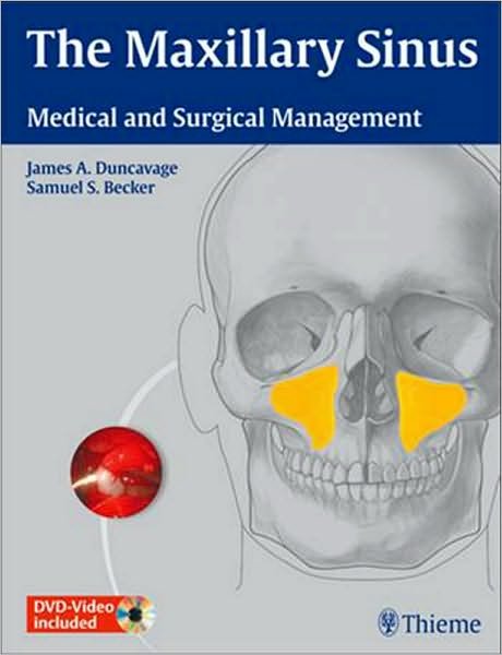 The Maxillary Sinus: Medical and Surgical Management - James A. Duncavage - Kirjat - Thieme Medical Publishers Inc - 9781604062809 - perjantai 22. lokakuuta 2010