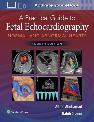 Cover for Alfred Z. Abuhamad · A Practical Guide to Fetal Echocardiography: Normal and Abnormal Hearts (Inbunden Bok) (2022)