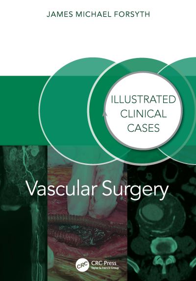 Cover for James Forsyth · Vascular Surgery:: Illustrated Clinical Cases - Illustrated Clinical Cases (Paperback Book) (2024)