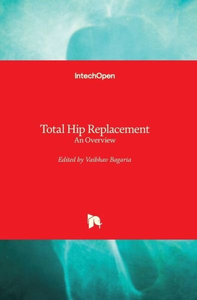 Cover for Vaibhav Bagaria · Total Hip Replacement: An Overview (Inbunden Bok) (2018)
