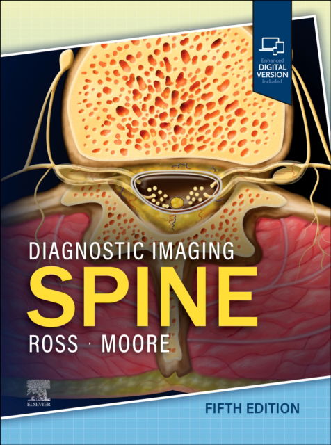 Cover for Ross, Jeffrey S. (Consultant, Neuroradiology Division, Department of Radiology, Mayo Clinic Arizona, Professor of Radiology, Mayo Clinic College of Medicine, Phoenix, Arizona, USA) · Diagnostic Imaging: Spine (Hardcover Book) (2025)