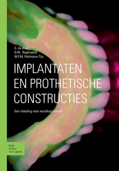 Cover for C De Baat · Implantaten en Prothetische Constructies: Een Inleiding Voor Mondhygienisten (Paperback Book) (2003)