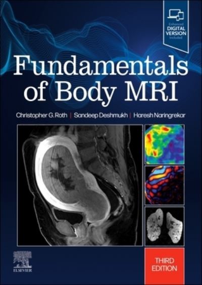 Cover for Roth, Christopher G. (Professor Interim Chair Department of Radiology Thomas Jefferson University Philadelphia, Pennsylvania) · Fundamentals of Body MRI - Fundamentals of Radiology (Taschenbuch) (2024)