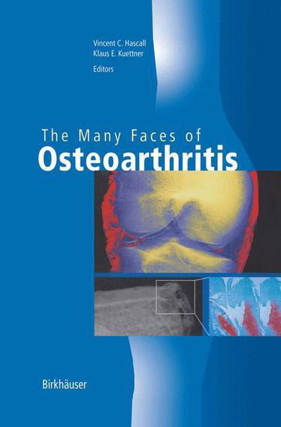 Cover for Vincent C Hascall · The Many Faces of Osteoarthritis (Hardcover Book) [2002 edition] (2002)