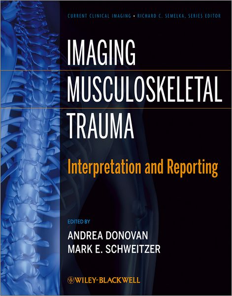 Cover for A Donovan · Imaging Musculoskeletal Trauma: Interpretation and Reporting - Current Clinical Imaging (Hardcover Book) (2012)