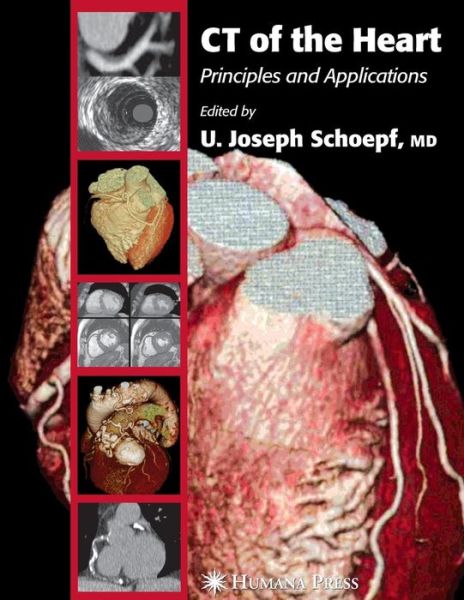 Ct of the Heart - Contemporary Cardiology - U Joseph Schoepf - Livros - Humana Press Inc. - 9781617374814 - 1 de dezembro de 2010