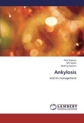 Cover for Dheeraj Kapoor · Ankylosis: and It's Management (Paperback Book) (2012)