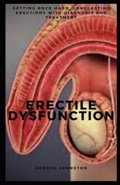 Cover for George Johnston · Erectile Dysfunction: Getting rock hard, longlasting erections with diagnosis and treatment (Paperback Book) (2022)